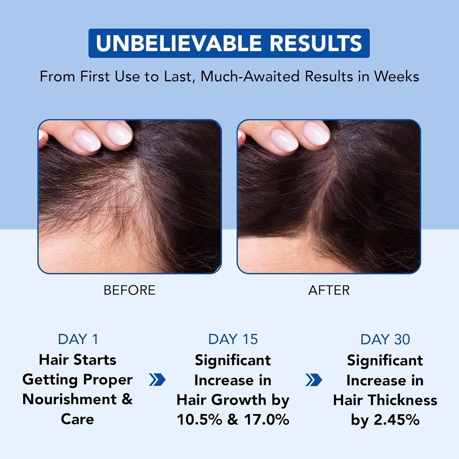 Botanic Hearth - Huile capillaire croissance - 198ml - romarin, biotine, ricin, jojoba